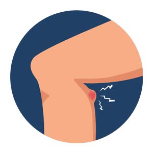 Pain at the back of the knee